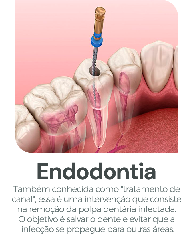 endo
